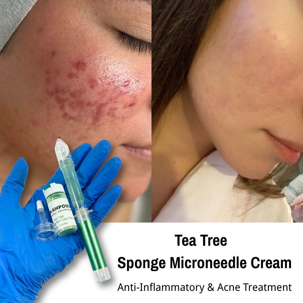 Sponge Microneedle Cream Tea-Tree