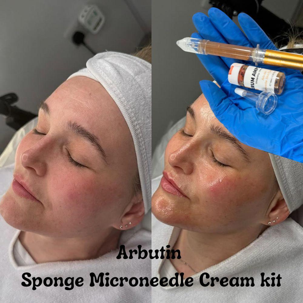 Sponge Microneedle Cream- Arbutin