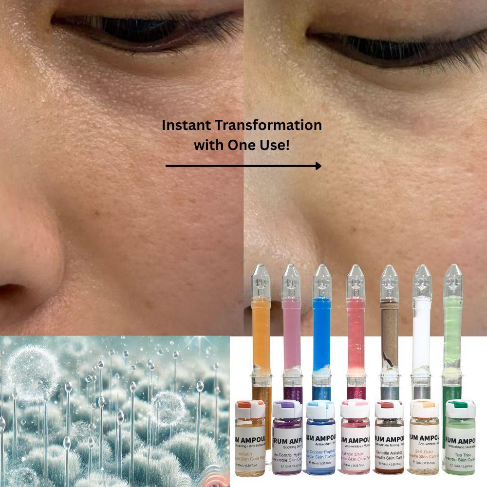 Sponge Microneedle Cream Tea-Tree