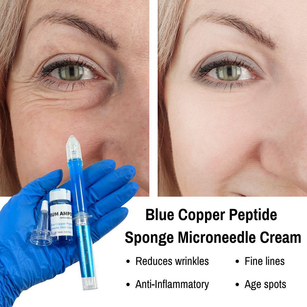 Sponge Microneedle Cream- Blue Copper Peptide