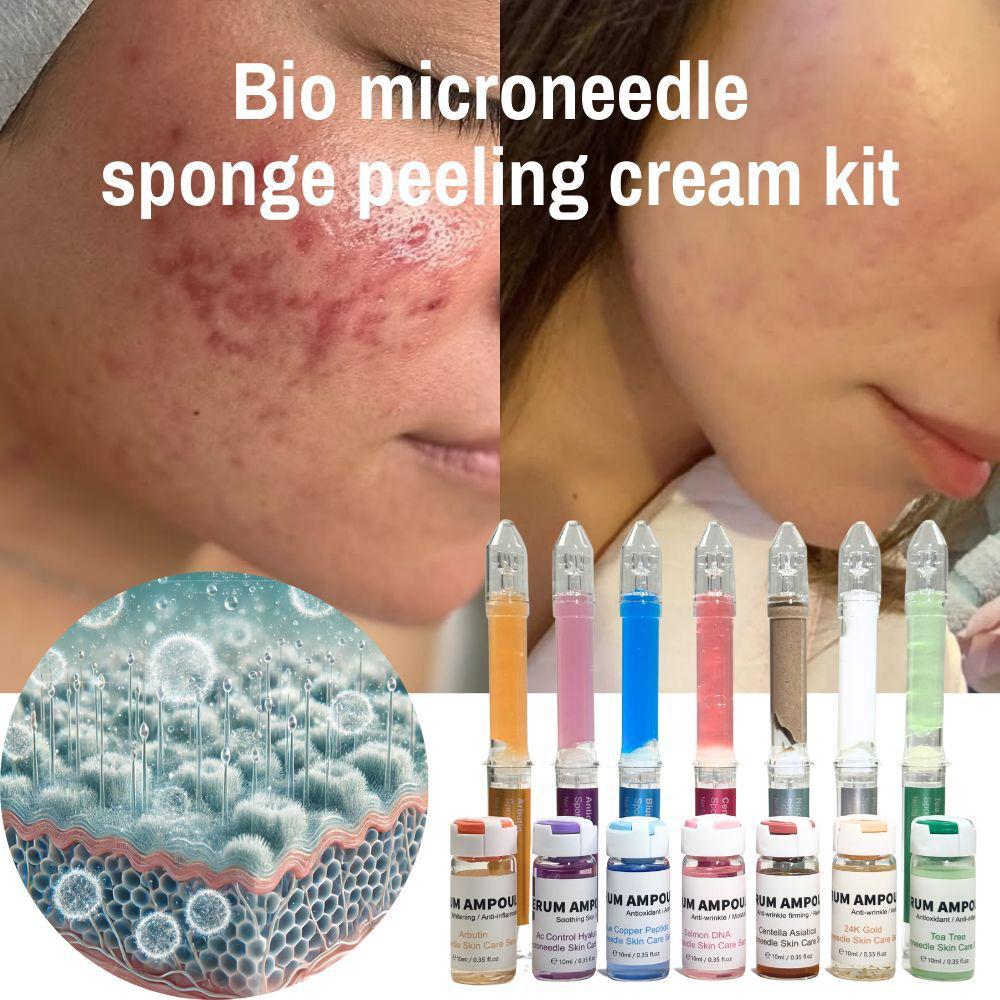 Sponge Microneedle Cream- Arbutin