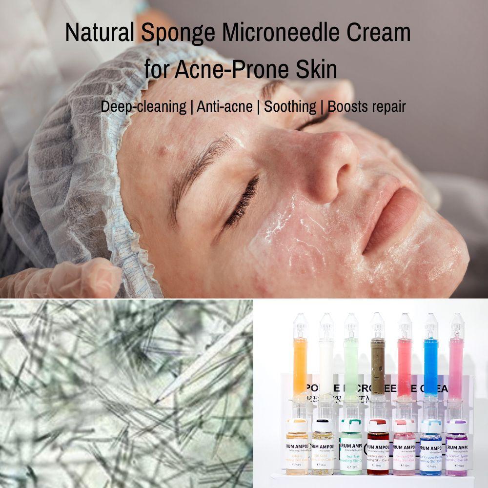 Sponge Microneedle Cream- Arbutin