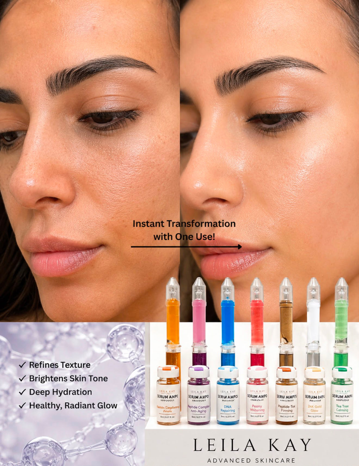 Sponge Microneedle Cream- Arbutin